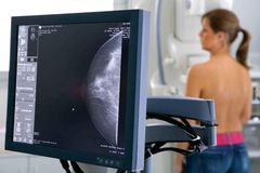В Глазове появился новый маммограф